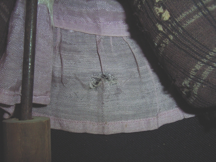 Foro gonna prima del restauro